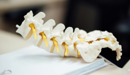 Anatomical cervical spine model illustrating cervical disc replacement and motion preservation in the neck