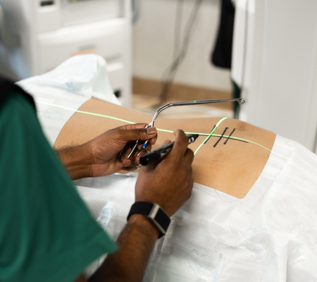 Dr Jaytesh Pillay planning a minimally invasive spine surgery procedure using precision guidance before surgery