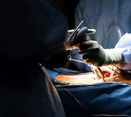 Dr Jaytesh Pillay performing navigation-assisted spine surgery using advanced real-time surgical guidance technology